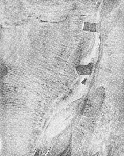 Radiograph